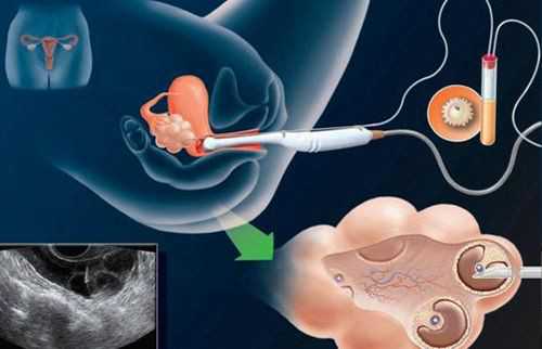 医院没有三代试管婴儿吗