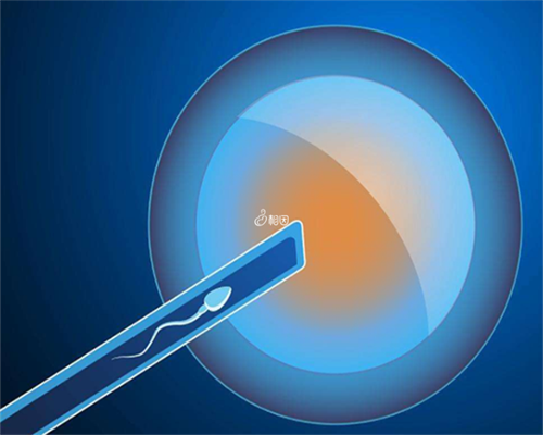 试管婴儿女性怎么取卵