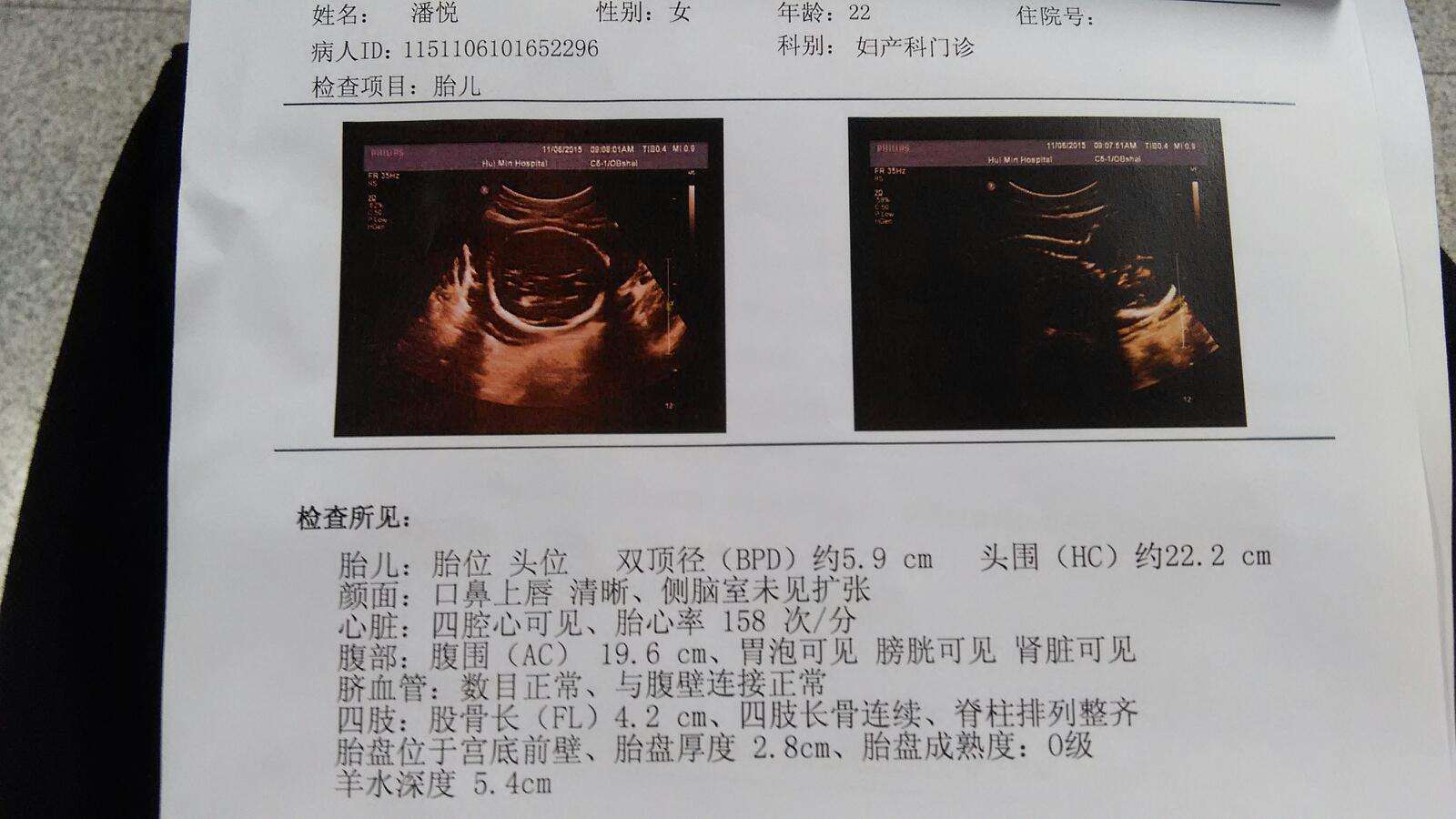 判断胎儿是男孩还是女孩，产检时最好这样问大夫，3种问法肯定行