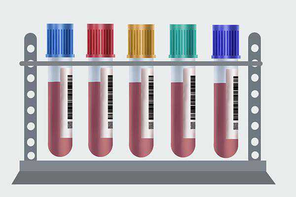 验血能检查出什么？如何正确看懂化验单？