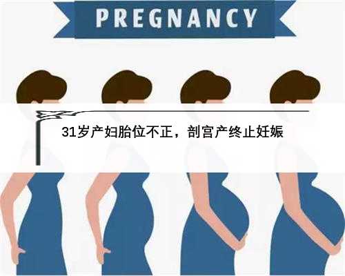 31岁产妇胎位不正，剖宫产终止妊娠